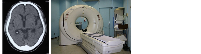 X線CT検査